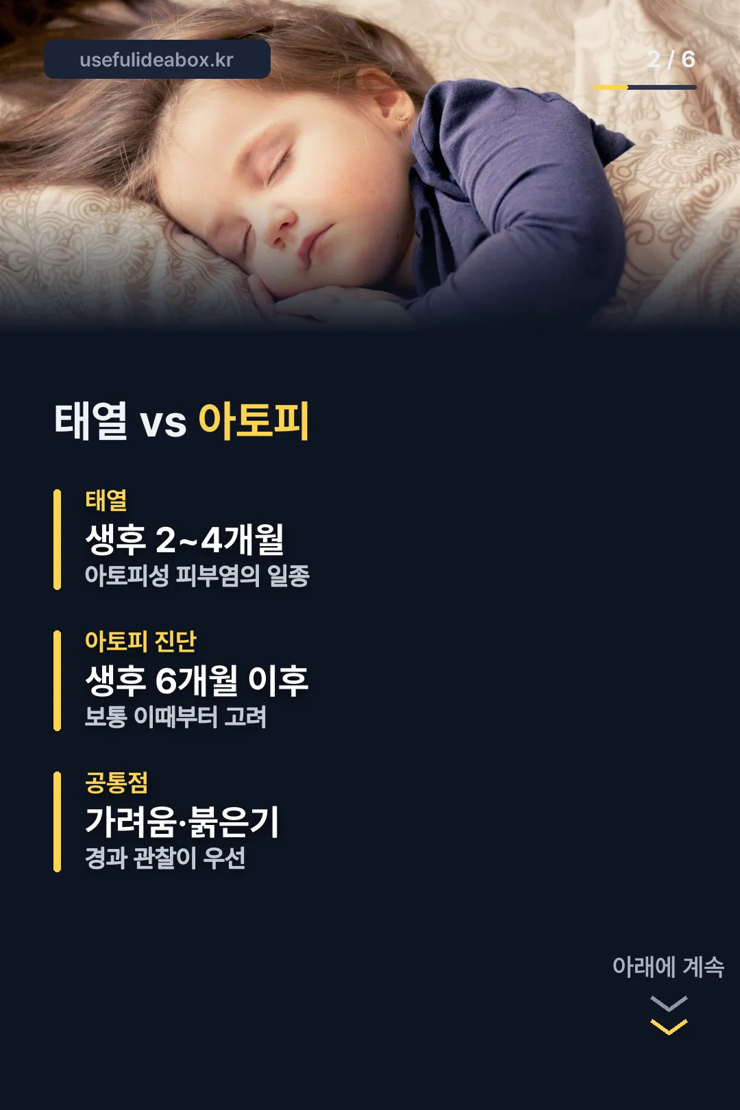 태열과 아토피 구분